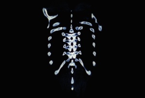 STATION 34 - ONKOLOGIE