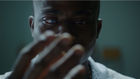 A STORY ABOUT MY EYES