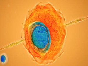 15 BILHÕES DE FATIAS DE (-T) + DEUS